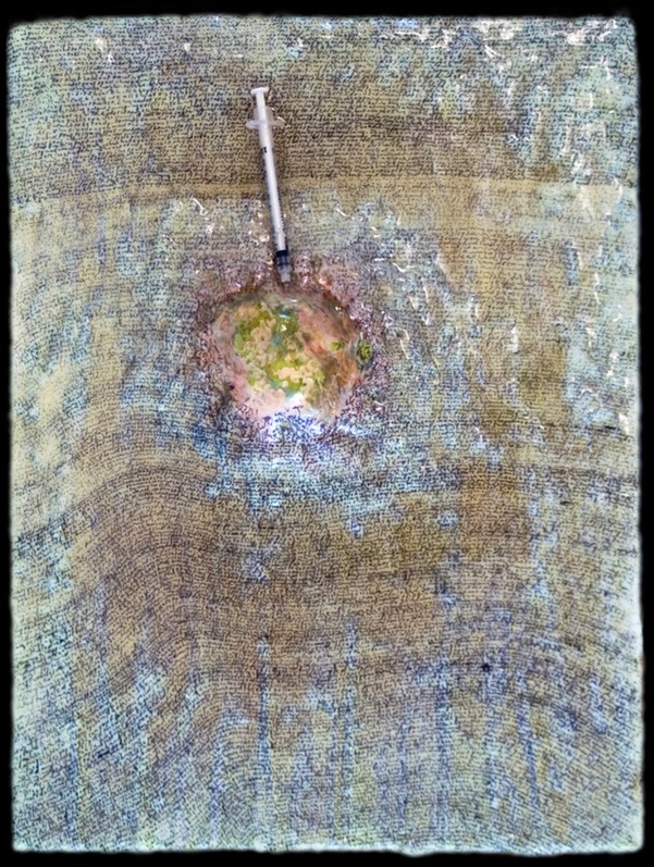 Drew Wood, Euphoric Cyst, 2006 phosphorus, acrylic, ink writings (stream of consciousness), syringe, old personal shoe laces, encaustic, and synthetic resin on canvas,16"x12"x1" 